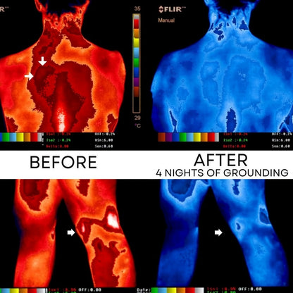 TerraGround™ Grounding Bedsheet